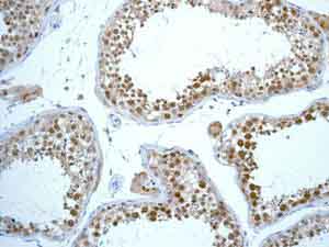 Immunohistochemistry (Formalin/PFA-fixed paraffin-embedded sections) - Anti-Rad51 antibody [EPR4030(3)] (ab133534), expandable thumbnail