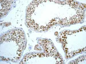Immunohistochemistry (Formalin/PFA-fixed paraffin-embedded sections) - Anti-Rad51 antibody [EPR4030(3)] (AB133534)