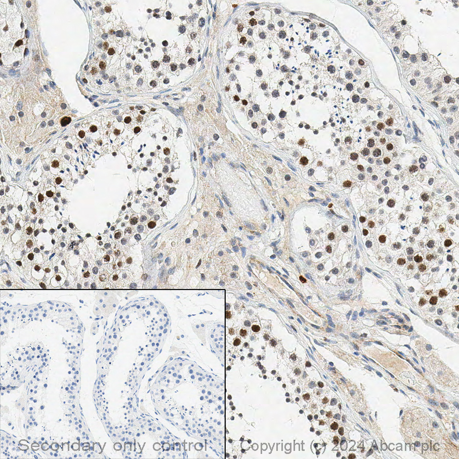 Immunohistochemistry (Formalin/PFA-fixed paraffin-embedded sections) - Anti-Rad51 antibody [EPR4030(3)] (ab133534), expandable thumbnail