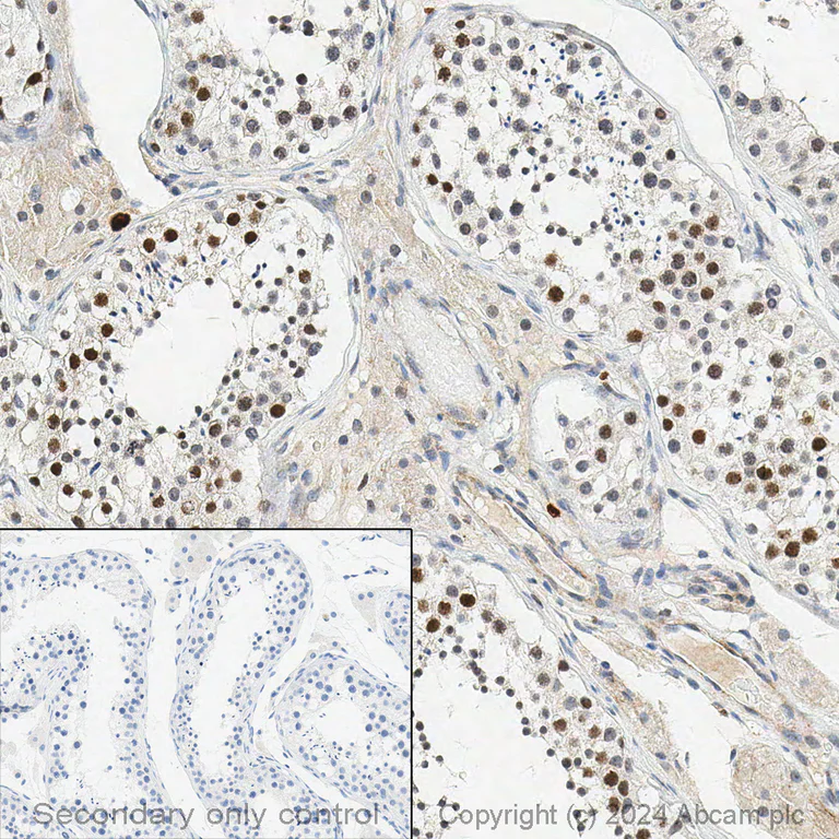 Immunohistochemistry (Formalin/PFA-fixed paraffin-embedded sections) - Anti-Rad51 antibody [EPR4030(3)] (AB133534)