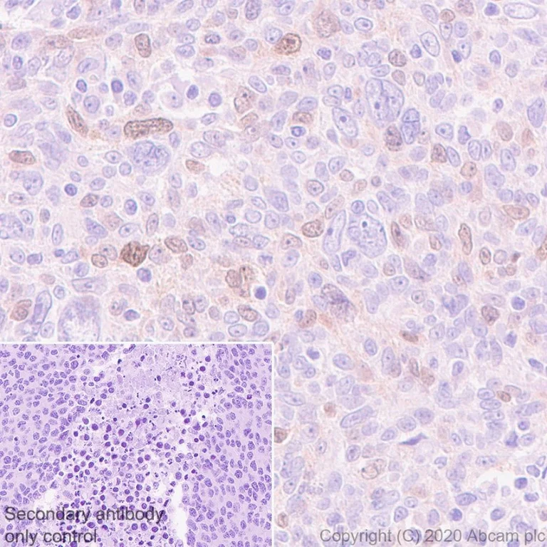 Immunohistochemistry (Formalin/PFA-fixed paraffin-embedded sections) - Anti-Rad51 antibody [EPR4030(3)] (AB133534)