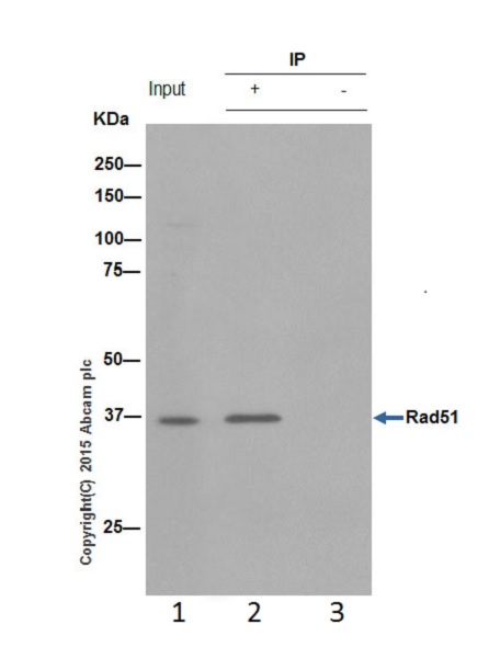 Immunoprecipitation - Anti-Rad51 antibody [EPR4030(3)] (AB133534), expandable thumbnail