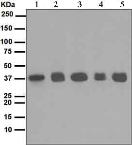Western blot - Anti-Rad51 antibody [EPR4030(3)] (ab133534), expandable thumbnail