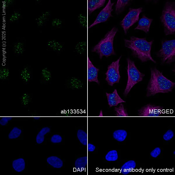 Immunocytochemistry/ Immunofluorescence - Anti-Rad51 antibody [EPR4030(3)] - BSA and Azide free (AB221796)