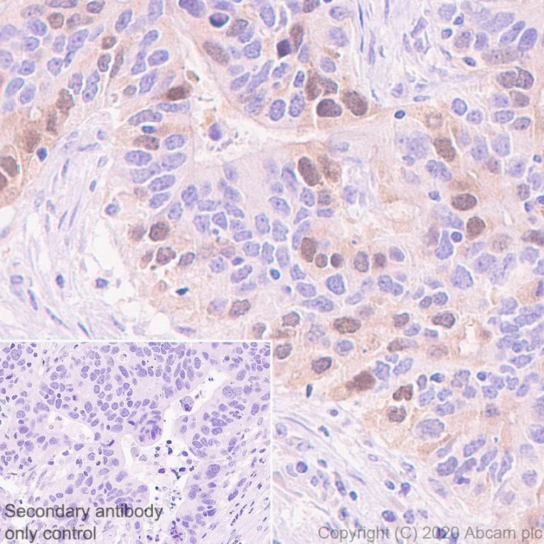 Immunohistochemistry (Formalin/PFA-fixed paraffin-embedded sections) - Anti-Rad51 antibody [EPR4030(3)] - BSA and Azide free (AB221796)