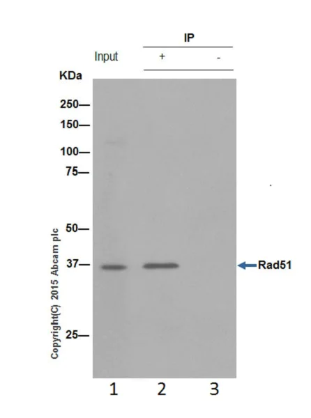 Immunoprecipitation - Anti-Rad51 antibody [EPR4030(3)] - BSA and Azide free (AB221796)