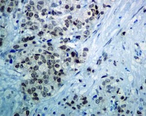 Immunohistochemistry (Formalin/PFA-fixed paraffin-embedded sections) - Anti-Rad51 antibody [EPR4031(23)] - BSA and Azide free (AB234634)