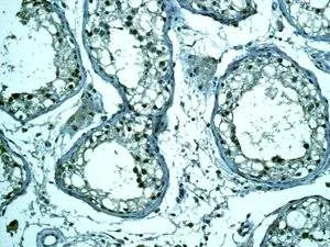 Immunohistochemistry (Formalin/PFA-fixed paraffin-embedded sections) - Anti-Rad51 antibody [EPR4031(23)] - BSA and Azide free (AB234634)