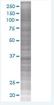 Rad51 overexpression 293T lysate (whole cell)