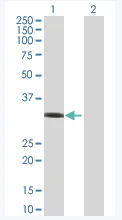 Western blot - Rad51 overexpression 293T lysate (whole cell) (AB94044)