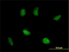Immunocytochemistry/ Immunofluorescence - Anti-RAD51AP1 antibody (AB88370)
