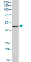 Western blot - Anti-RAD51AP1 antibody (AB88370)