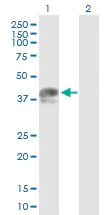 Western blot - Anti-RAD51AP1 antibody (AB88370)