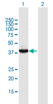 Western blot - Anti-Rad51C antibody (AB172270), expandable thumbnail