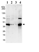 Western blot - Anti-Rad51C antibody (AB95069)