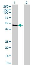 Western blot - Rad51C overexpression 293T lysate (whole cell) (AB94121)