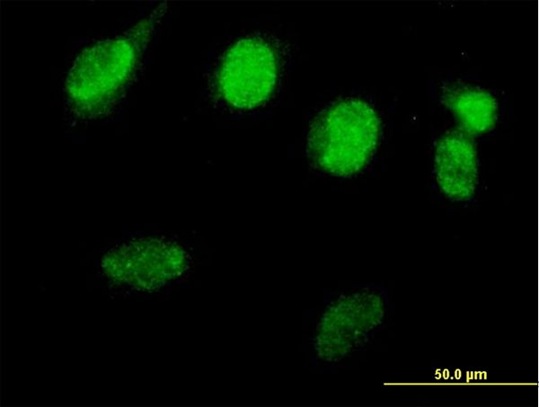 Immunocytochemistry/ Immunofluorescence - Anti-Rad51D antibody (AB168463), expandable thumbnail