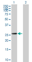 Western blot - Anti-Rad51D antibody (AB168463)