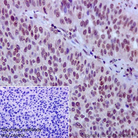 Immunohistochemistry (Formalin/PFA-fixed paraffin-embedded sections) - Anti-Rad51D antibody [EPR16205] (AB202063)