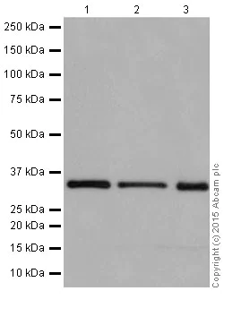 Western blot - Anti-Rad51D antibody [EPR16205] (AB202063)