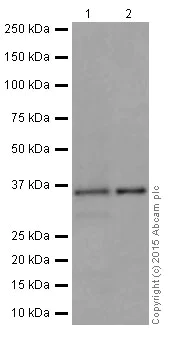 Western blot - Anti-Rad51D antibody [EPR16205] (AB202063)