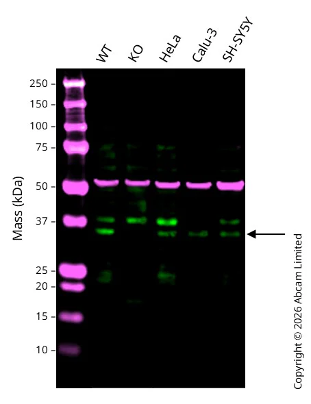 Western blot - Anti-Rad51D antibody [EPR16205] (AB202063)