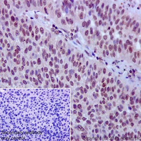 Immunohistochemistry (Formalin/PFA-fixed paraffin-embedded sections) - Anti-Rad51D antibody [EPR16205] - BSA and Azide free (AB236144)