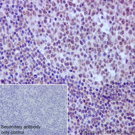 Immunohistochemistry (Formalin/PFA-fixed paraffin-embedded sections) - Anti-Rad51D antibody [EPR16205] - BSA and Azide free (AB236144)