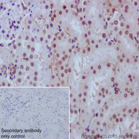Immunohistochemistry (Formalin/PFA-fixed paraffin-embedded sections) - Anti-Rad51D antibody [EPR16205] - BSA and Azide free (AB236144)