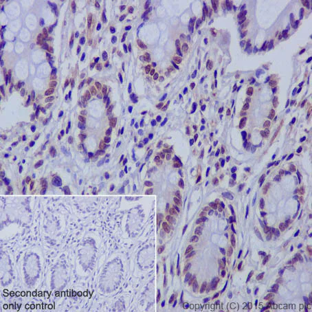 Immunohistochemistry (Formalin/PFA-fixed paraffin-embedded sections) - Anti-Rad51D antibody [EPR16205] - BSA and Azide free (AB236144)