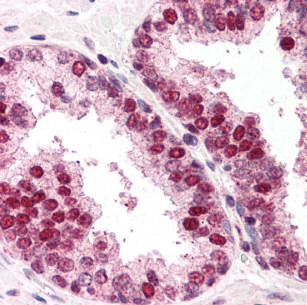 Immunohistochemistry (Formalin/PFA-fixed paraffin-embedded sections) - Anti-RAD52 antibody (AB117097)