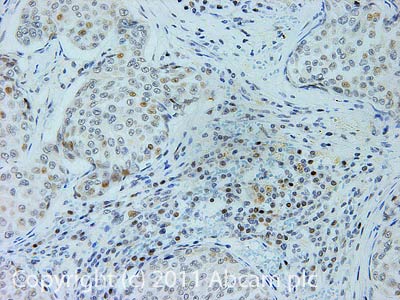 Immunohistochemistry (Formalin/PFA-fixed paraffin-embedded sections) - Anti-RAD54 antibody (AB10705)