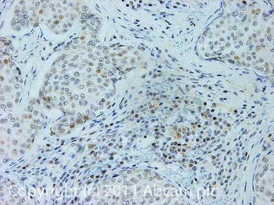 Immunohistochemistry (Formalin/PFA-fixed paraffin-embedded sections) - Anti-RAD54 antibody (AB10705)