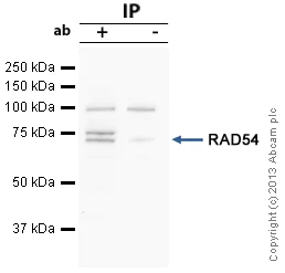 Immunoprecipitation - Anti-RAD54 antibody (AB10705)