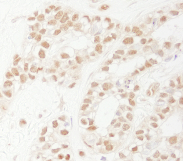 Immunohistochemistry (Formalin/PFA-fixed paraffin-embedded sections) - Anti-Rad9 antibody (AB70810), expandable thumbnail