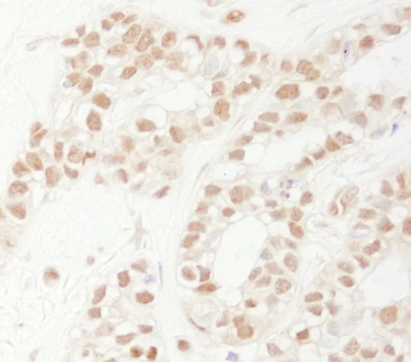 Immunohistochemistry (Formalin/PFA-fixed paraffin-embedded sections) - Anti-Rad9 antibody (AB70810)