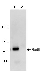 Immunoprecipitation - Anti-Rad9 antibody (AB70810), expandable thumbnail