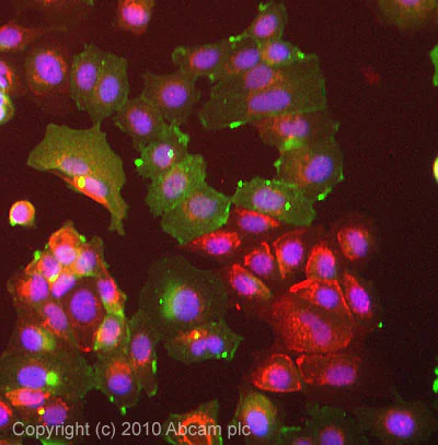 Immunocytochemistry/ Immunofluorescence - Anti-Radixin/RDX antibody [EP1862Y] (AB52495)