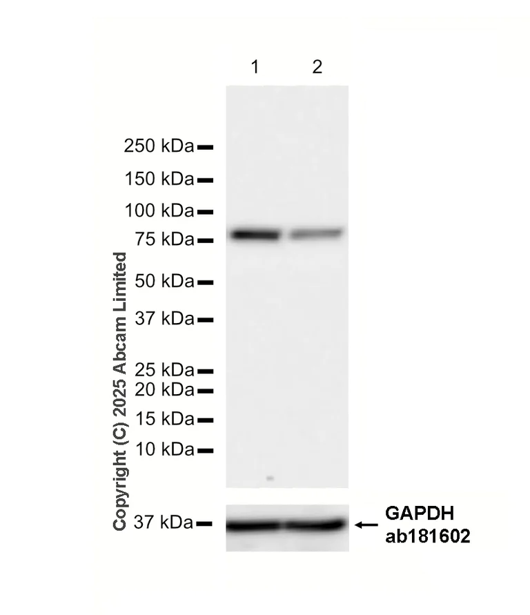 Western blot - Anti-Radixin/RDX antibody [EP1862Y] (AB52495)