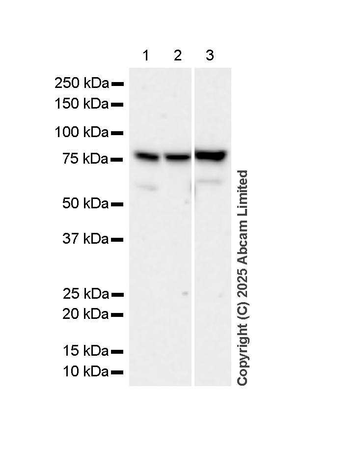 Western blot - Anti-Radixin/RDX antibody [EP1862Y] (AB52495)