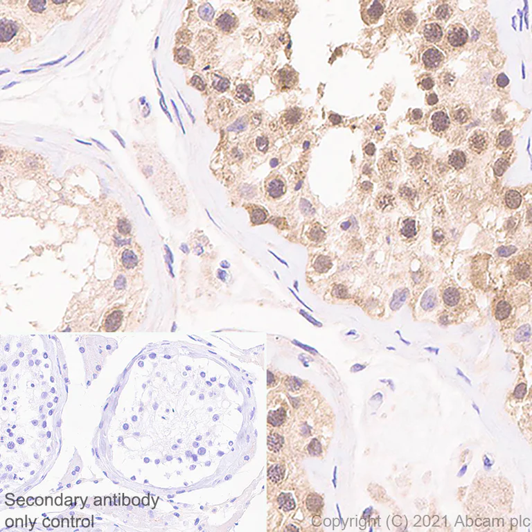 Immunohistochemistry (Formalin/PFA-fixed paraffin-embedded sections) - Anti-RAE1 antibody [EPR6923] (AB124783)