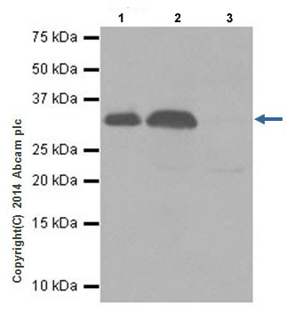 Immunoprecipitation - Anti-RAET1E antibody [EPR17443] - BSA and Azide free (AB251318)