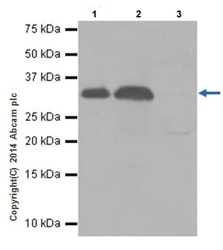 Immunoprecipitation - Anti-RAET1E antibody [EPR17443] - BSA and Azide free (AB251318)