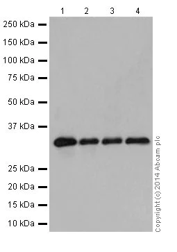 Western blot - Anti-RAET1E antibody [EPR17443] - BSA and Azide free (AB251318)