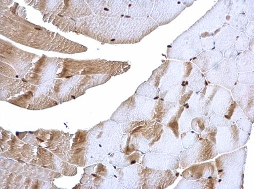 Immunohistochemistry (Formalin/PFA-fixed paraffin-embedded sections) - Anti-Raf1 antibody (AB137435), expandable thumbnail