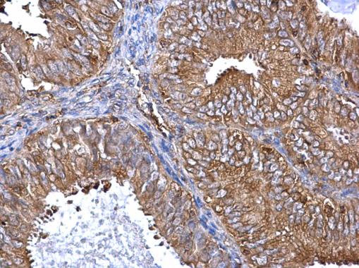 Immunohistochemistry (Formalin/PFA-fixed paraffin-embedded sections) - Anti-Raf1 antibody (AB137435), expandable thumbnail