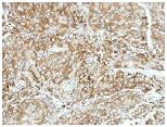 Immunohistochemistry (Formalin/PFA-fixed paraffin-embedded sections) - Anti-Raf1 antibody (AB137435), expandable thumbnail
