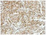Immunohistochemistry (Formalin/PFA-fixed paraffin-embedded sections) - Anti-Raf1 antibody (AB137435)