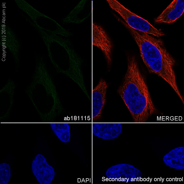 Immunocytochemistry/ Immunofluorescence - Anti-Raf1 antibody [EP4969] - BSA and Azide free (AB236003)