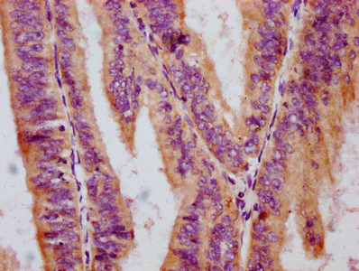 Immunohistochemistry (Formalin/PFA-fixed paraffin-embedded sections) - Anti-Raf1 (phospho S259) antibody [4C9] (AB314036)
